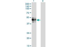 Western Blot analysis of CD177 expression in transfected 293T cell line by CD177 monoclonal antibody (M01), clone 4C4. (CD177 anticorps  (AA 21-120))