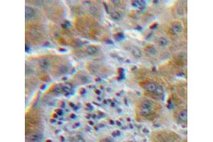 IHC-P analysis of Liver tissue, with DAB staining. (CSF3R anticorps  (AA 26-138))