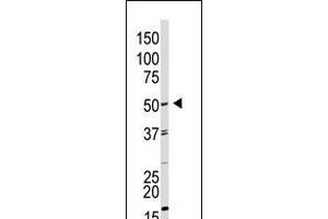 Antibody is used in Western blot to detect GDF9 in HL60 cell lysate. (GDF9 anticorps  (N-Term))