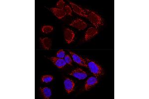 Confocal immunofluorescence analysis of U2OS cells using MTX2 Polyclonal Antibody (ABIN6129694, ABIN6144192, ABIN6144193 and ABIN6223964) at dilution of 1:100. (MTX2 anticorps  (AA 1-263))