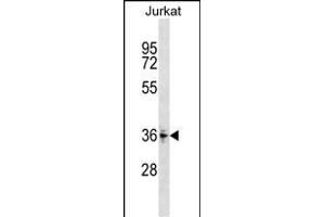 ZN Antibody (Center) (ABIN1537998 and ABIN2849075) western blot analysis in Jurkat cell line lysates (35 μg/lane). (ZNF346 anticorps  (AA 188-214))