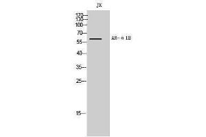 Western Blotting (WB) image for anti-Adrenergic, alpha-1B-, Receptor (ADRA1B) (C-Term) antibody (ABIN3180500)