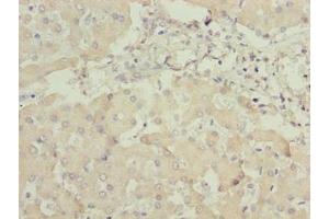 Immunohistochemistry of paraffin-embedded human liver tissue using ABIN7144243 at dilution of 1:100 (ANKRA2 anticorps  (AA 1-313))