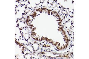 Immunohistochemistry of paraffin-embedded mouse lung using  Rabbit pAb (ABIN7265407) at dilution of 1:25 (40x lens).