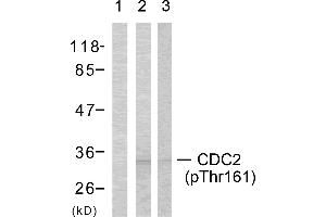 Western blot analysis using CDC2 (Phospho-Thr161) Antibody: Lin: The extracts from COLO cells using preincubated with synthesized phosphopeptide; Lin: The extracts from COLO cells. (CDK1 anticorps  (pThr161))