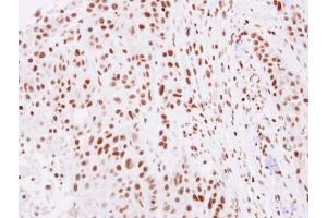 IHC-P Image Immunohistochemical analysis of paraffin-embedded SCC4 xenograft, using Histone H2A. (H2AFZ anticorps  (N-Term))