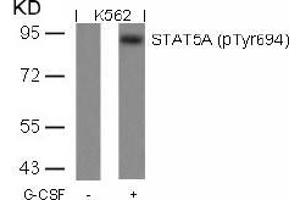 Image no. 1 for anti-Signal Transducer and Activator of Transcription 5A (STAT5A) (pTyr694) antibody (ABIN196697) (STAT5A anticorps  (pTyr694))