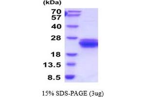 SDS-PAGE (SDS) image for C-Type Lectin Domain Family 7, Member A (CLEC7A) (AA 71-244) protein (His tag) (ABIN5854489)
