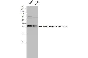 WB Image Triosephosphate isomerase antibody detects Triosephosphate isomerase protein by western blot analysis. (TPI1 anticorps  (C-Term))
