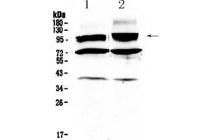 Western blot analysis of HCN2 using anti- HCN2 antibody . (HCN2 anticorps  (C-Term))