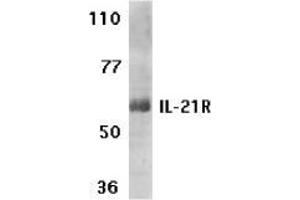 Western blot analysis of IL-21 receptor expression in human Raji cell lysate with AP30415PU-N IL-21 receptor antibody at 1 μg /ml. (IL21 Receptor anticorps  (N-Term))