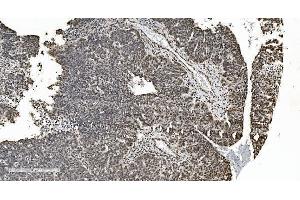 IHC analysis of HNRNPH3 using anti-HNRNPH3 antibody (ABIN7601121).