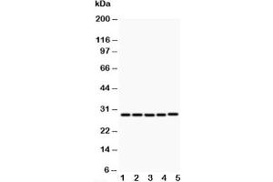 Western blot testing of CD40L antibody and Lane 1:  MCF-7 (CD40 Ligand anticorps  (N-Term))