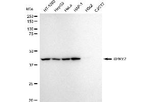 Western blotting analysis using SPRY2 antibody (ABIN7800428).