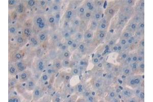 Detection of IL2 in Mouse Liver Tissue using Polyclonal Antibody to Interleukin 2 (IL2) (IL-2 anticorps  (AA 10-169))
