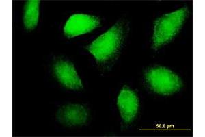 Immunofluorescence of purified MaxPab antibody to FLT3LG on HeLa cell. (FLT3LG anticorps  (AA 1-235))