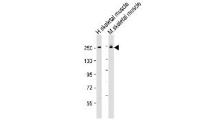 All lanes : Anti-MYH6 Antibody (Center) at 1:2000 dilution Lane 1: human skeletal muscle lysate Lane 2: mouse skeletal muscle lysate Lysates/proteins at 20 μg per lane. (MYH6 anticorps  (AA 833-867))