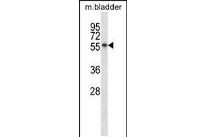 Western blot analysis in mouse bladder tissue lysates (35ug/lane). (SGK3 anticorps  (C-Term))