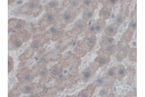 Detection of CF6 in Human Liver Tissue using Polyclonal Antibody to Coupling Factor 6 (CF6)