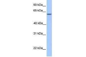 WB Suggested Anti-MTL5 Antibody Titration: 0. (MTL5 anticorps  (N-Term))