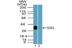 Image no. 1 for anti-SRY (Sex Determining Region Y)-Box 2 (SOX2) (AA 100-150) antibody (ABIN1490795)