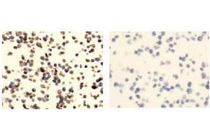 Immunohistochemistry (IHC) image for anti-Tumor Necrosis Factor Receptor Superfamily, Member 13C (TNFRSF13C) antibody (ABIN1449226) (TNFRSF13C anticorps)