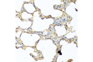Immunohistochemistry of paraffin-embedded mouse lung using PIP antibody (ABIN6131693, ABIN6145670, ABIN6145672 and ABIN6222022) at dilution of 1:100 (40x lens).