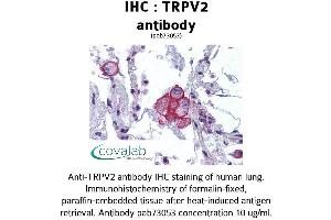 Image no. 2 for anti-Transient Receptor Potential Cation Channel, Subfamily V, Member 2 (TRPV2) (AA 595-764) antibody (ABIN1740401)