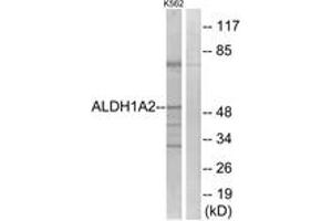 Western blot analysis of extracts from K562 cells, using ALDH1A2 Antibody. (ALDH1A2 anticorps  (AA 412-461))