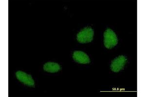 Immunofluorescence of purified MaxPab antibody to ZNF549 on HeLa cell.