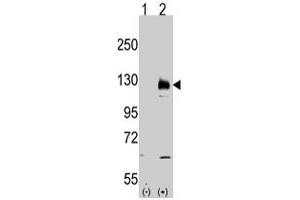 Western blot analysis of TRPM8 (arrow) using rabbit TRPM8 polyclonal antibody . (TRPM8 anticorps  (AA 933-963))