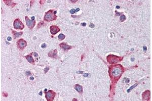 Human Brain, Cortex: Formalin-Fixed, Paraffin-Embedded (FFPE)