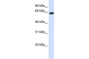 Western Blotting (WB) image for anti-Solute Carrier Family 39 (Zinc Transporter), Member 4 (SLC39A4) antibody (ABIN2458809) (SLC39A4 anticorps)
