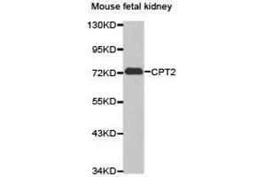 Western Blotting (WB) image for anti-Carnitine Palmitoyltransferase 2 (CPT2) antibody (ABIN1871991) (CPT2 anticorps)