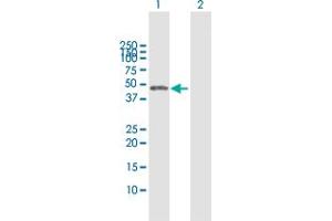 Western Blot analysis of CTBS expression in transfected 293T cell line by CTBS MaxPab polyclonal antibody.