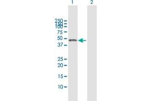 Western Blot analysis of CTBS expression in transfected 293T cell line by CTBS MaxPab polyclonal antibody. (CTBS anticorps  (AA 1-385))