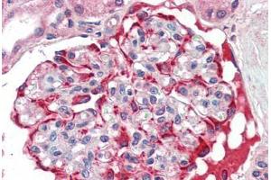 Human Kidney (formalin-fixed, paraffin-embedded) stained with SLC29A1 antibody ABIN462073 followed by biotinylated goat anti-rabbit IgG secondary antibody ABIN481713, alkaline phosphatase-streptavidin and chromogen.
