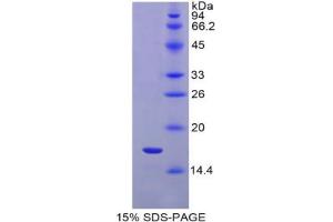 SDS-PAGE analysis of Rat IL1R1 Protein. (IL1R1 Protéine)