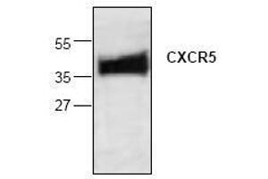Image no. 1 for anti-Chemokine (C-X-C Motif) Receptor 5 (CXCR5) antibody (ABIN127100) (CXCR5 anticorps)