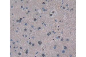 Used in DAB staining on fromalin fixed paraffin- embedded liver tissue