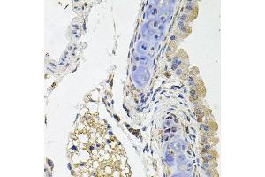 Immunohistochemistry of paraffin-embedded mouse lung using SDC2 antibody at dilution of 1:100 (x40 lens). (Syndecan 2 anticorps)