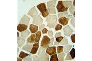 anti-Zinc Finger, SWIM-Type Containing 6 (ZSWIM6) (AA 1153-1183), (C-Term) antibody