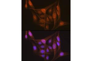 Immunofluorescence analysis of U-2 OS cells using LIS1 Rabbit mAb (ABIN7269401) at dilution of 1:100 (40x lens).