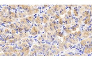 Detection of mTOR in Human Stomach Tissue using Monoclonal Antibody to Serine/threonine-protein kinase mTOR (mTOR)
