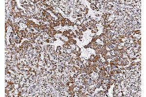 IHC analysis of BCKDHA using anti-BCKDHA antibody (ABIN7601223).