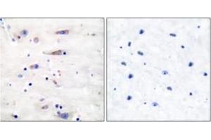 Immunohistochemistry analysis of paraffin-embedded human brain tissue, using NMDAR1 (Ab-897) Antibody. (GRIN1/NMDAR1 anticorps  (AA 864-913))