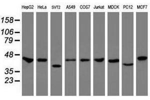 Image no. 3 for anti-Chromobox Homolog 8 (CBX8) (AA 1-260) antibody (ABIN1490659) (CBX8 anticorps  (AA 1-260))