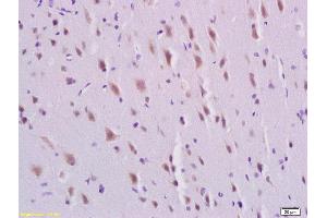 Formalin-fixed and paraffin embedded rat brain labeled with Rabbit Anti-PDGFBB Polyclonal Antibody, Unconjugated  at 1:200 followed by conjugation to the secondary antibody and DAB staining, (PDGF-BB Homodimer (AA 151-241) anticorps)