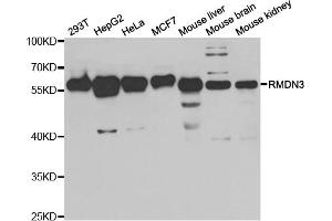 Western blot analysis of extracts of various cell lines, using RMDN3 antibody (ABIN5973434) at 1/1000 dilution. (RMDN3 anticorps)