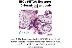 Image no. 2 for anti-5-Hydroxytryptamine (serotonin) Receptor 2A (HTR2A) (C-Term) antibody (ABIN1731361) (HTR2A anticorps  (C-Term))